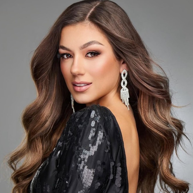 9 người đẹp nổi bật tại Hoa hậu Thế giới 2025- Ảnh 11.