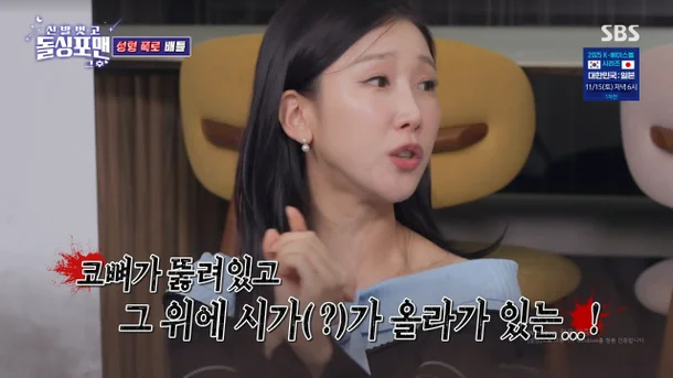 Chưa từng có tiền lệ: Sao nữ “dao kéo” công khai ảnh chụp CT silicon trong mũi trên sóng truyền hình- Ảnh 1.