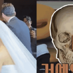 Chưa từng có tiền lệ: Sao nữ “dao kéo” công khai ảnh chụp CT silicon trong mũi trên sóng truyền hình so8 17624937667581196089926 0 0 352 672 crop 1762493780732349493037gifpng