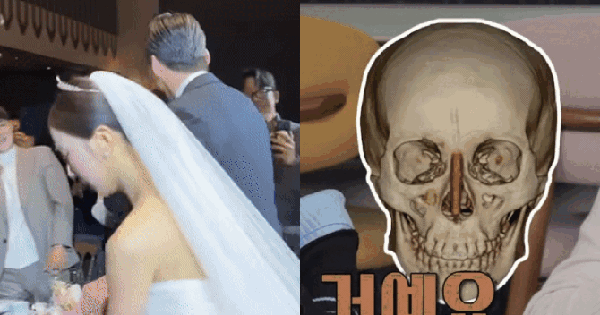 Chưa từng có tiền lệ: Sao nữ “dao kéo” công khai ảnh chụp CT silicon trong mũi trên sóng truyền hình so8 17624937667581196089926 0 0 352 672 crop 1762493780732349493037gifpng