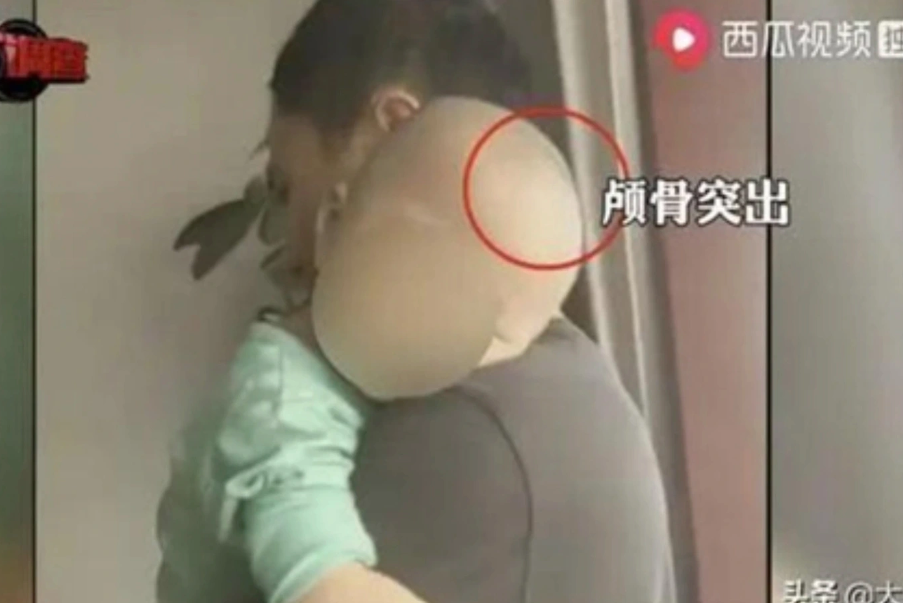 Những vụ bê bối sữa giả gây ám ảnh suốt 7 thập kỷ: Hàng loạt trẻ tử vong, ảnh hưởng trí tuệ, các giám đốc lĩnh án tử hình- Ảnh 3.