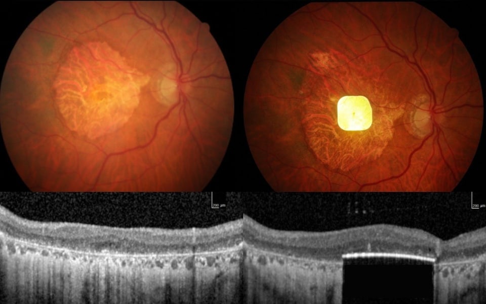 Vật thể chỉ 2mm làm nên điều kỳ diệu, giúp người mù đọc sách trở lại- Ảnh 2. Vật thể chỉ 2mm làm nên điều kỳ diệu, giúp người mù đọc sách trở lại- Ảnh 2.