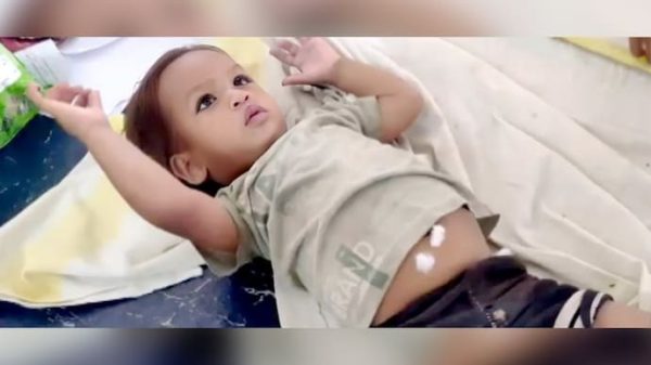 Hy hữu: Em bé hai tuổi cắn chết rắn hổ mang chúa the incident occurred when the c 1753673532135 1753673532857308978577