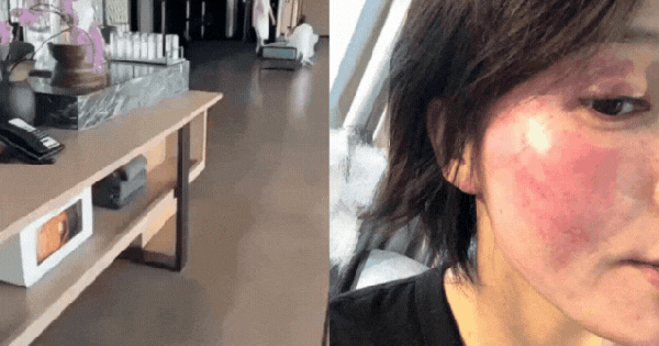 Mỹ nam lộ clip đưa gái lạ đi Phú Quốc bị vợ cũ tố cáo bạo hành đến biến dạng mặt mũi, sảy thai thiet ke chua co ten 18 17574938792081038985643 1757496112466824847244 83 0 418 640 crop 1757496131970599986498gifpng