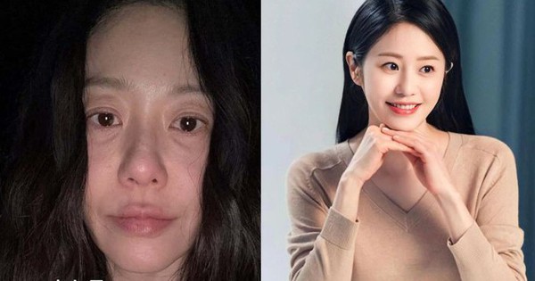 "Á hậu từng bị đế chế Samsung ruồng bỏ" lộ mặt mộc sau phẫu thuật, gây xôn xao với lời thừa nhận về tuổi tác thiet ke chua co ten 2 1737605162802218379695 0 0 500 800 crop 17376051651801020141467 1737610615400172231789 30 0 396 700 crop 1737610628946161264304jpg