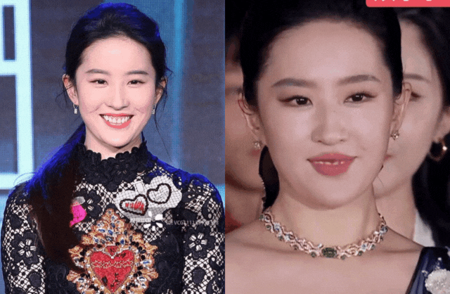 4 khuyết điểm nhan sắc