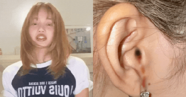 Lisa (BLACKPINK) lên tiếng về bức ảnh chảy máu tai gây hoang mang khắp MXH thiet ke chua co ten 70 1751524770633899070327 0 0 335 640 crop 17515247880952115690695gifpng