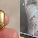 Con trai nuốt miếng vàng của mẹ vào bụng và cái kết thoi vang 17617122743951697201057 1761793712010 1761793712880239494959 0 116 1050 1796 crop 17617937363022072595775jpg