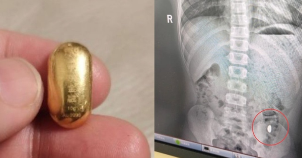 Con trai nuốt miếng vàng của mẹ vào bụng và cái kết thoi vang 17617122743951697201057 1761793712010 1761793712880239494959 0 116 1050 1796 crop 17617937363022072595775jpg