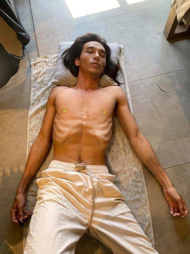 Màn lột xác gây sốc nhất Vbiz: Mỹ nam gầy như “ma đói