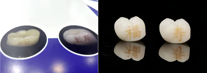 Độc lạ trào lưu xăm răng của giới trẻ Trung Quốc- Ảnh 1.