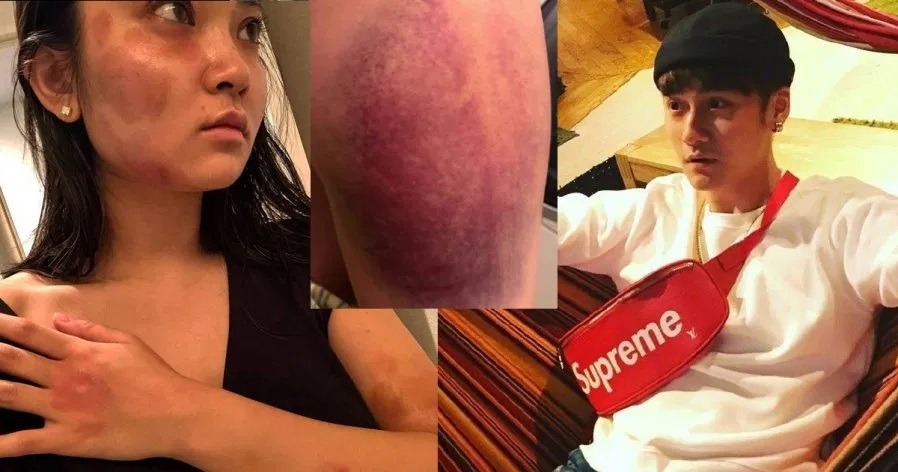 Chuyện nghiêm trọng gì đã xảy ra với