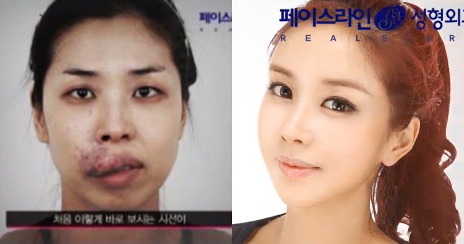 Cô gái vô danh khiến cả showbiz sững sờ với màn Cô gái vô danh khiến cả showbiz sững sờ với màn