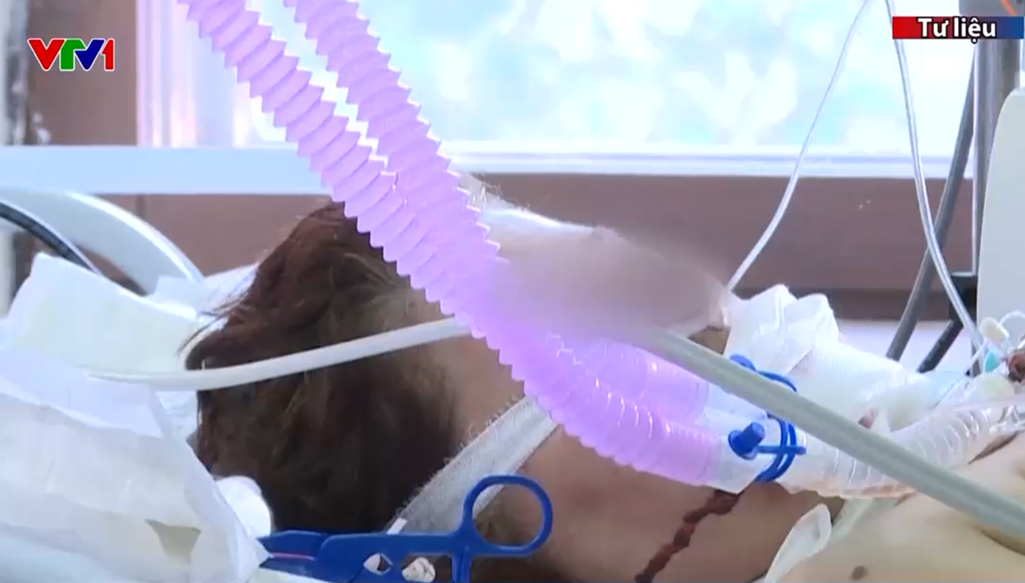 Phát hiện virus lạ tại Nga gây sốt và ho ra máu- Ảnh 1.