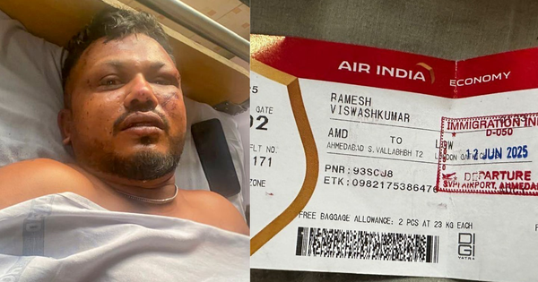 Tình hình hiện tại của người sống sót duy nhất trong thảm kịch máy bay Air India sau 3 tháng vishwashkumarramesh17497752326241749775241712 17580118937281049231612 0 0 900 1440 crop 1758011904944566212918png