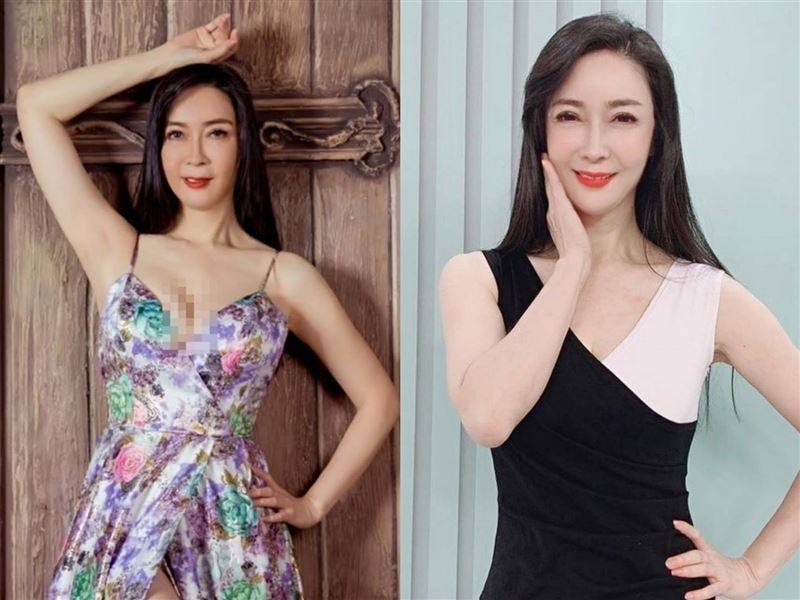 "Nữ hoàng dao kéo" chuyển từ giường bệnh ung thư sang… giường phẫu thuật thẩm mỹ, gây mê suốt 6 tiếng để căng da! w1200 1753966914501 17539669148061031880440