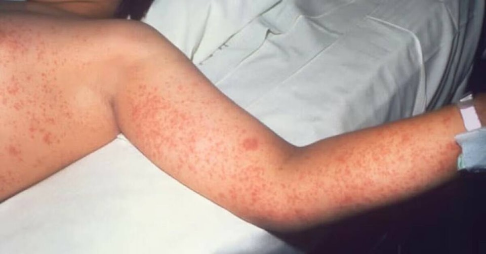 Canada mất trạng thái