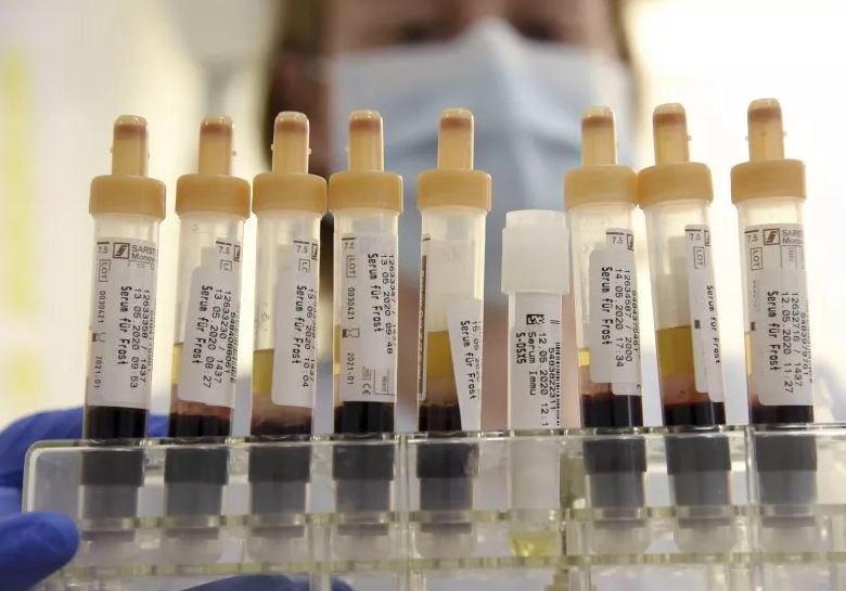 Thế giới phát hiện nhóm máu mới: Sở hữu 1 chi tiết ‘bất thường’, tên gọi cũng rất đặc biệt- Ảnh 1.