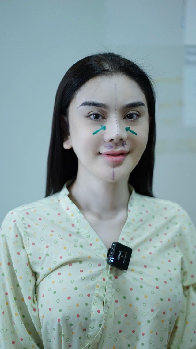 Sao nữ Vbiz bị hải quan giữ lại vì mặt lạ hoắc sau khi phẫu thuật thẩm mỹ, thừa nhận sức khỏe yếu đi rõ rệt- Ảnh 4.