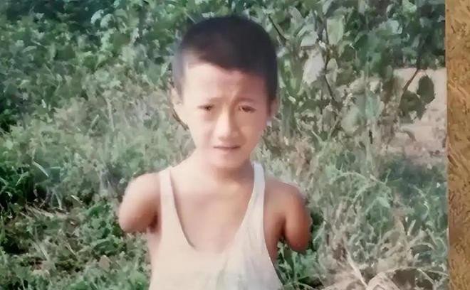 Cậu bé không tay, không chân và nghị lực phi thường. Ảnh: 163.com