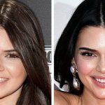 Kendall Jenner mà đẹp tự nhiên sao? 17 kendall icerik 17681323928151504516561 19 0 359 650 crop 17681324043332141240474jpg