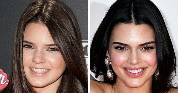 Kendall Jenner mà đẹp tự nhiên sao? 17 kendall icerik 17681323928151504516561 19 0 359 650 crop 17681324043332141240474jpg