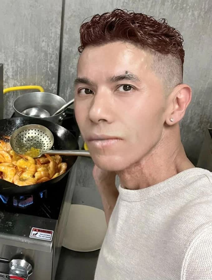 Những ngày cuối đời của ca sĩ Kasim Hoàng Vũ: Khuôn mặt biến dạng do bệnh u xương hàm, bế tắc vì chi phí chữa trị hàng tỷ đồng- Ảnh 4.