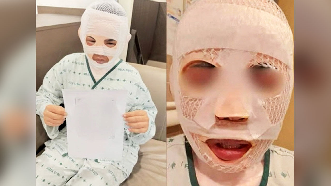 Vợ đang ngủ bị chồng tạt nước sôi vào mặt để huỷ dung vì sợ