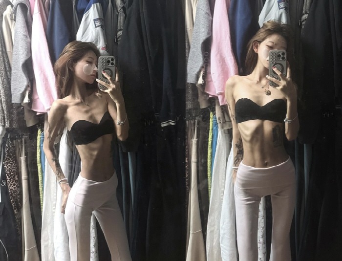 Phát sợ với cơ thể gầy trơ xương, héo mòn của con gái