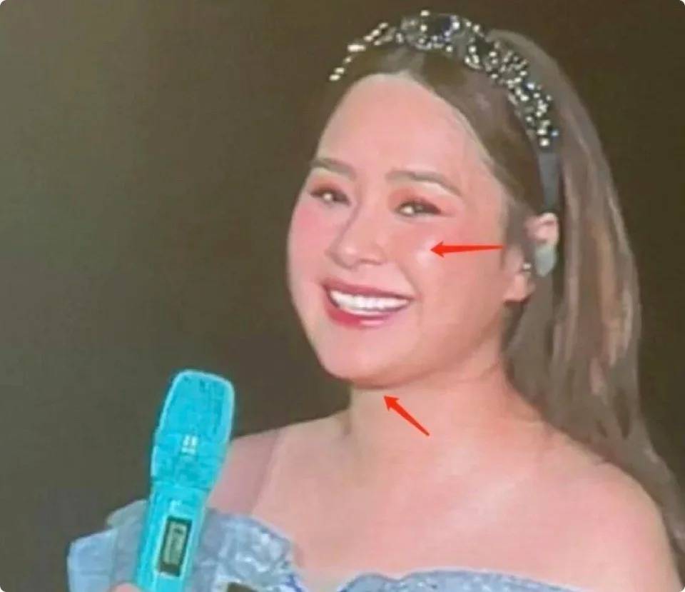 Đây thực sự là Chung Hân Đồng hậu phát tướng gây sốc, đột ngột tăng đến 75 kg- Ảnh 2.