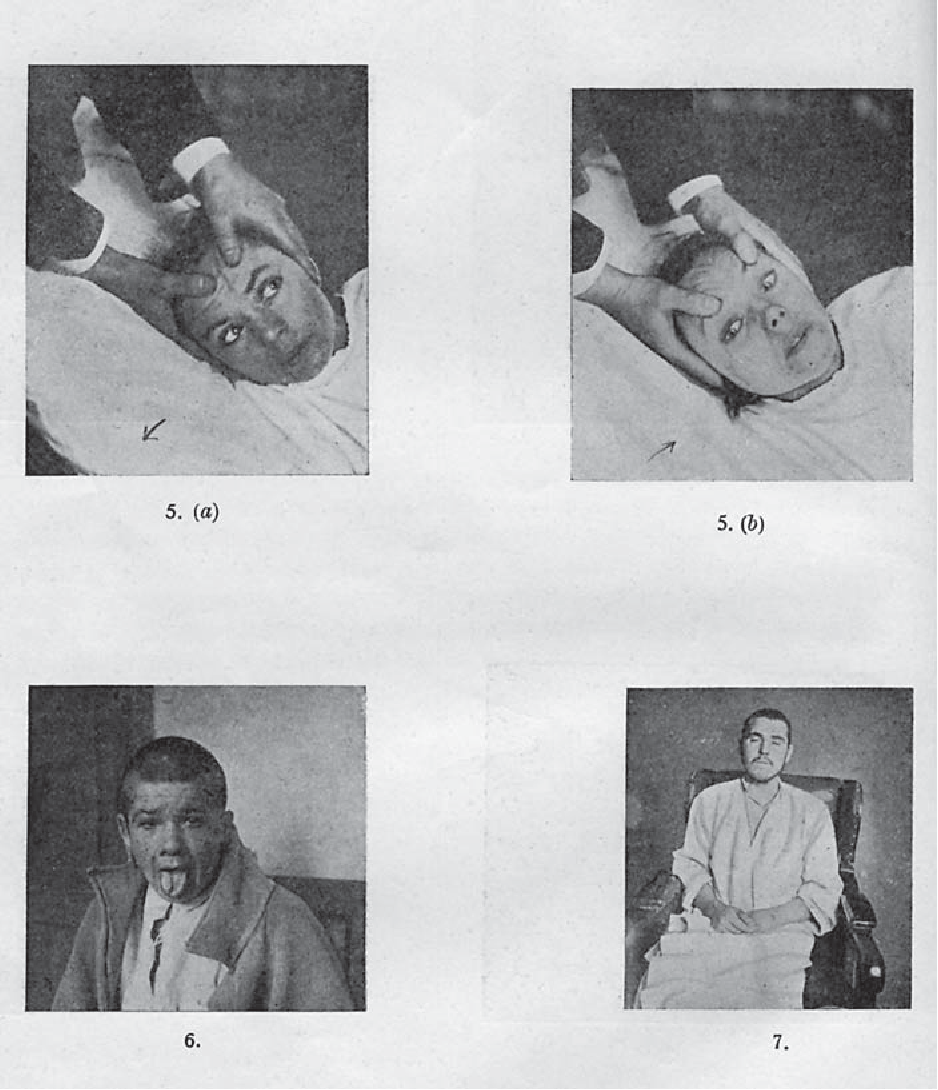 Bí ẩn về căn bệnh cướp đi 500.000 sinh mạng rồi đột ngột biến mất không một dấu vết- Ảnh 2.