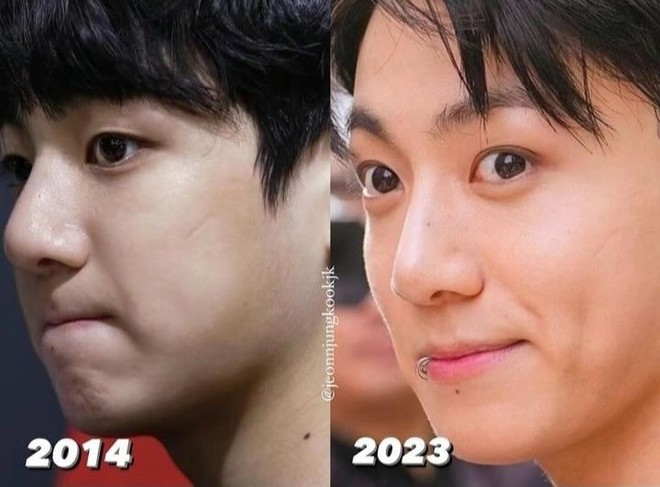 Jungkook (BTS) xin đừng làm chuyện này với gương mặt của mình nữa!- Ảnh 5.