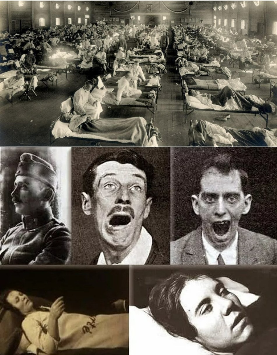 Bí ẩn về căn bệnh cướp đi 500.000 sinh mạng rồi đột ngột biến mất không một dấu vết- Ảnh 1.