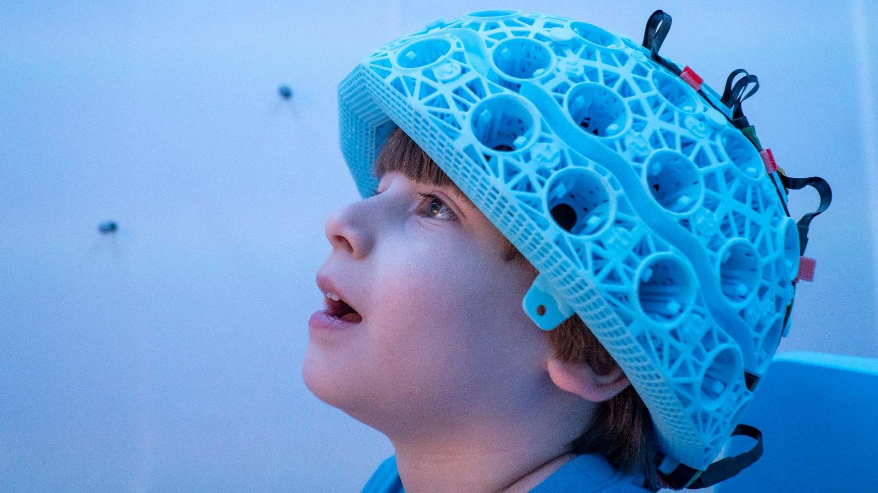 Các nhà khoa học đã đưa ra một cảnh báo khẩn cấp sau khi 250.000 bộ não được