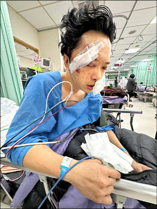Nam diễn viên Tô Đức Dương bị nạn nghiêm trọng- Ảnh 2.