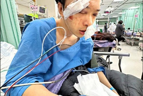 Nam diễn viên Tô Đức Dương bị nạn nghiêm trọng a1 1770520026404 1770520026669740399321