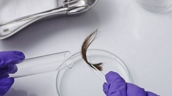 Thấy cháu không giống con trai, bà nội lén xét nghiệm ADN lộ ra bí mật khiến bà ngất xỉu adt1767841622 thumb xet nghiem adn 1 8423 0041 anh cat 3 2 auto cropjpg