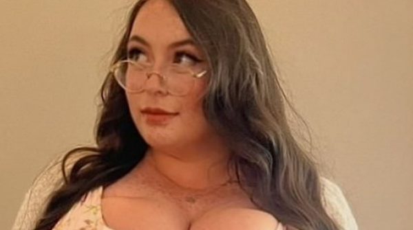 Cô gái khổ sở vì bộ ngực nặng 25 kg adt1768806646 nguc khung 5132 51 7311 5735 5209 anh cat 3 2 auto cropjpg