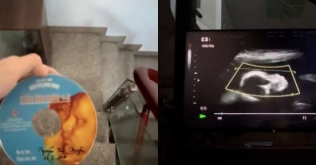 Clip siêu âm thai vừa tìm thấy và tâm thư người con làm dân mạng 'cay sống mũi' adt1768895724 add a heading 1 13 anh cat 3 2 auto cropjpg 1