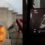 Clip siêu âm thai vừa tìm thấy và tâm thư người con làm dân mạng 'cay sống mũi' adt1768895724 add a heading 1 13 anh cat 3 2 auto cropjpg