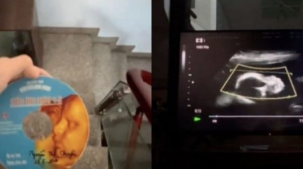 Clip siêu âm thai vừa tìm thấy và tâm thư người con làm dân mạng 'cay sống mũi' adt1768895724 add a heading 1 13 anh cat 3 2 auto cropjpg