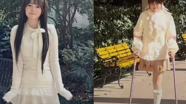 Cô gái ung thư xương bị gia đình bỏ rơi, tự ký giấy phẫu thuật 28 Cô gái ung thư xương bị gia đình bỏ rơi, tự ký giấy phẫu thuật adt1769255273 trungquoc1 4923 9430 6570 anh cat 3 2 auto cropjpg