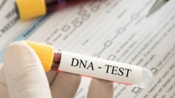 Xét nghiệm ADN ngày lễ: Từ niềm vui đoàn tụ đến bí mật gia đình bị phơi bày 28 Xét nghiệm ADN ngày lễ: Từ niềm vui đoàn tụ đến bí mật gia đình bị phơi bày adt1770481046 xet nghiem adn 59494 0 0 461 738 cro anh cat 3 2 auto cropjpg