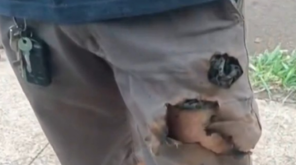 Điện thoại phát nổ cứu sống một người khỏi nanh vuốt chó dữ adt1772347593 phone explosion 58 anh cat 3 2 auto croppng