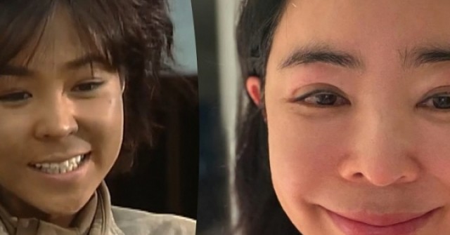 'Nàng Quạ' Lee Hye Young mắt sưng húp sau điều trị ung thư adt1772701258 jjj 8961 8976 9206 9296 anh cat 3 2 auto cropjpg 1