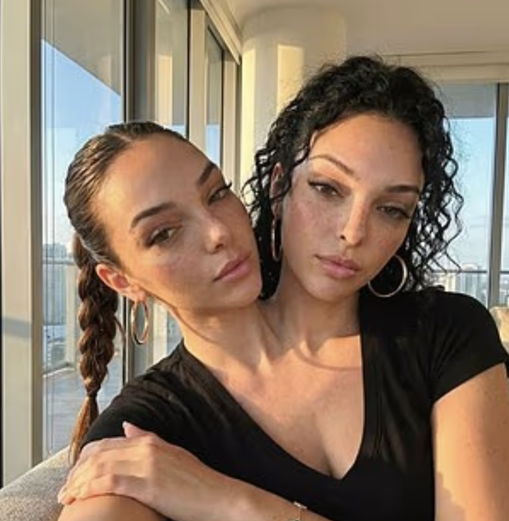 Sự thật khó tin về cặp song sinh dính liền thân đang gây bão mạng- Ảnh 2.