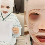 Vợ đang ngủ bị chồng tạt nước sôi vào mặt để huỷ dung vì sợ "gặp người đàn ông khác" avatar1765463129866 17654631305231928100256png