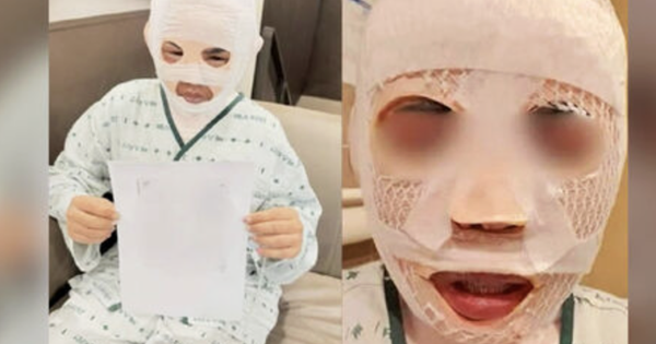 Vợ đang ngủ bị chồng tạt nước sôi vào mặt để huỷ dung vì sợ "gặp người đàn ông khác" avatar1765463129866 17654631305231928100256png