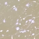 Lỗ hổng trong ngành thương mại tinh trùng tại châu Âu avatar1766796428509 17667964288702138733977 0 286 571 1200 crop 17667964465551145726688png