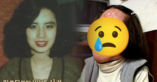 "Thảm họa thẩm mỹ" cuồng loạn tự tiêm dầu ăn vào mặt, từ mỹ nhân xinh đẹp cuối đời ra đi trong đau đớn avatar1766993525329 17669935264501756877419 0 12 346 672 crop 17669935472041102770173jpg